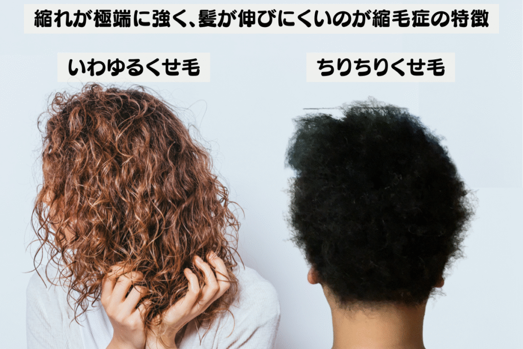 いわゆるくせ毛とちりちりくせ毛の比較画像